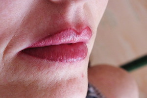 les lèvres